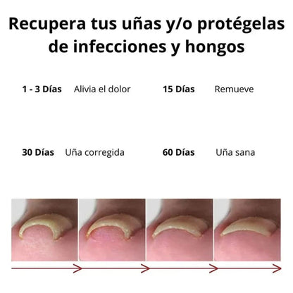 Suero Anti Hongos